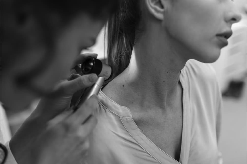 Núcleo de Dermatologia Oncológica