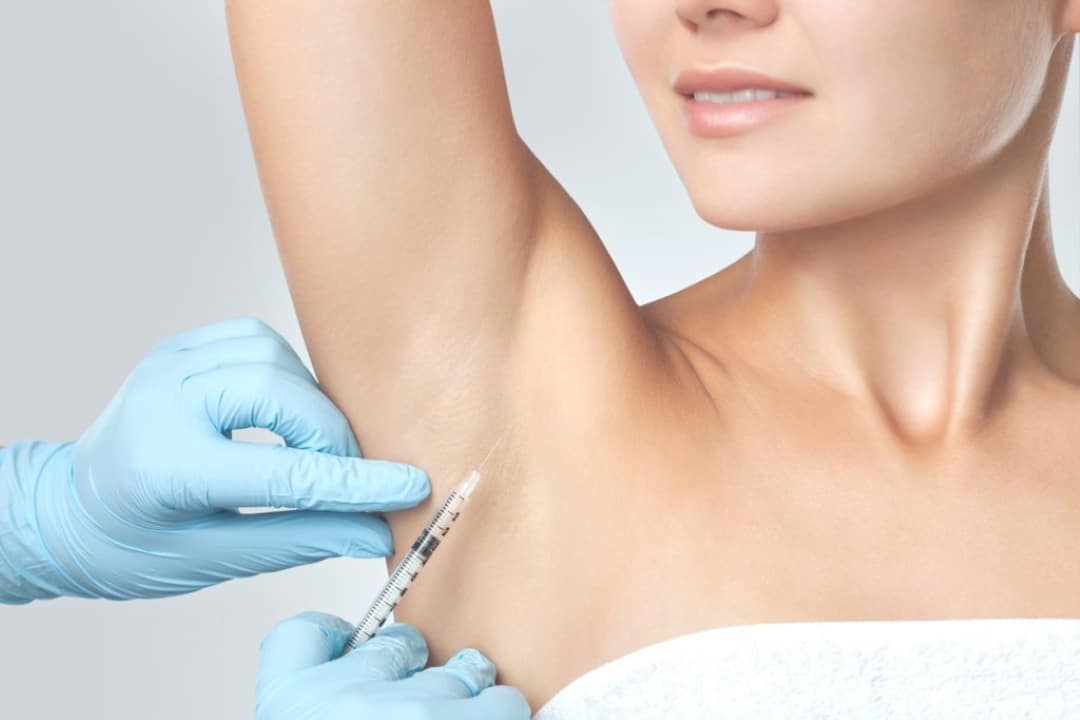 Hiperidrose: Como o Botox Pode Resolver o Suor Indesejado